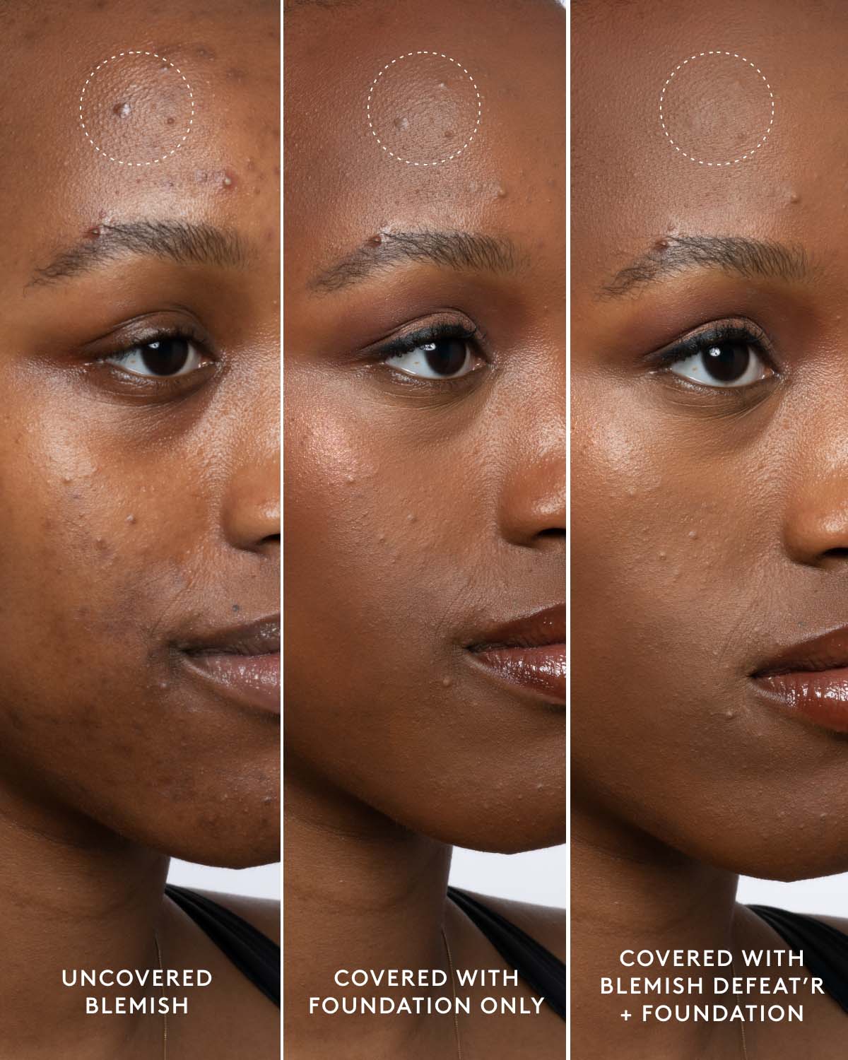 Blemish Defeat'r BHA Spot-Targeting Gel